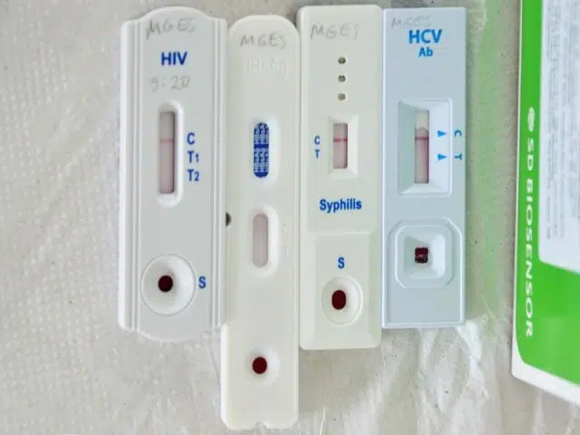 Teste IST infecções sexualmente transmissíveis