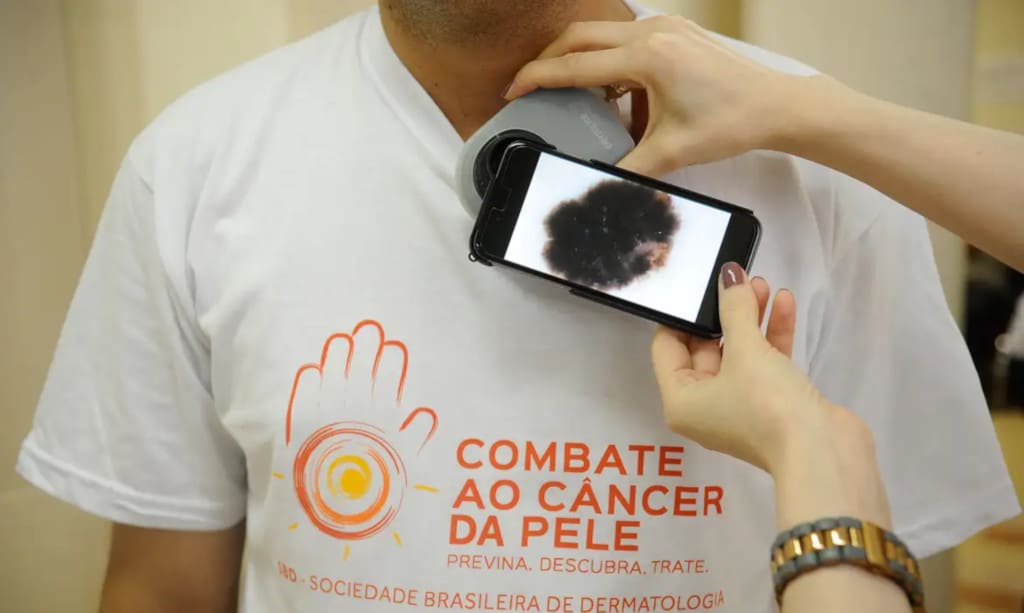 Mutirão atende população pelo país no dia de combate ao câncer de pele Mutirão atende população pelo país no dia de combate ao câncer de pele